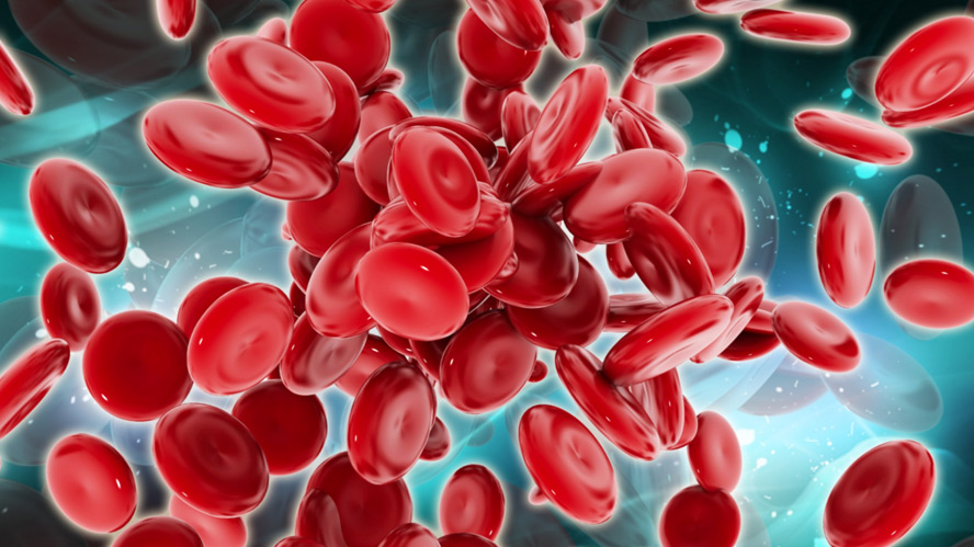 Полицитемия: лечение в Израиле