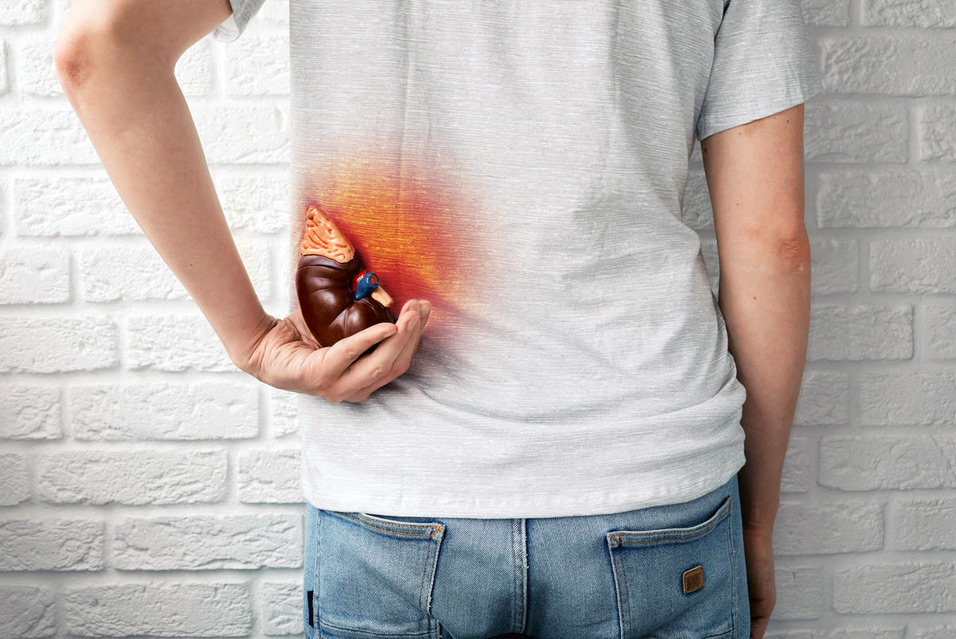 Дистопия почки