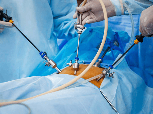 Лапароскопическическая хирургия