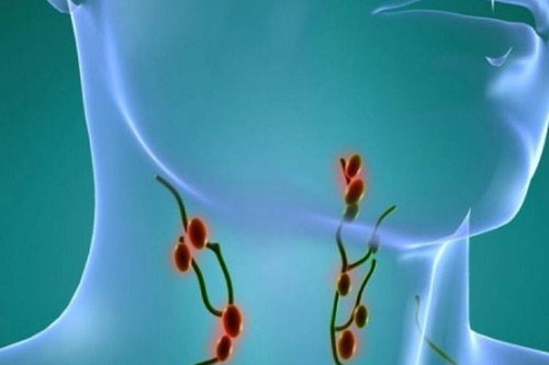 Лечение лимфопластической лимфомы в Израиле