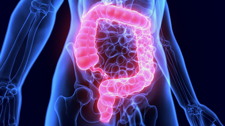 НПВП улучшает результаты лечения рака толстой кишки